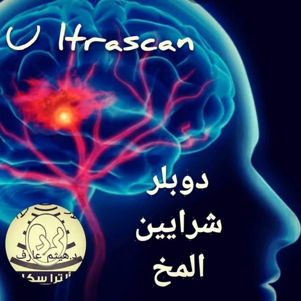 دوبلر شرايين المخ و الرقبه 4D