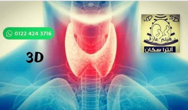 سونار الغده و الرقبه ثلاثي الابعاد بالاستوجرافي