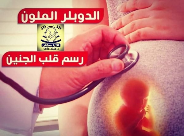 رسم قلب الجنين