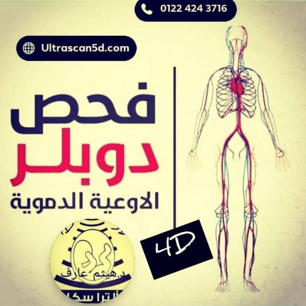 دوبلر ثلاثي الأبعاد عالاورده و الشرايين