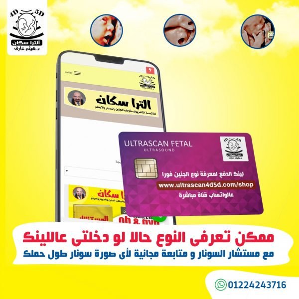 معرفه نوع الجنين مبكرا مع د.هيثم عارف و ممكن اونلاين