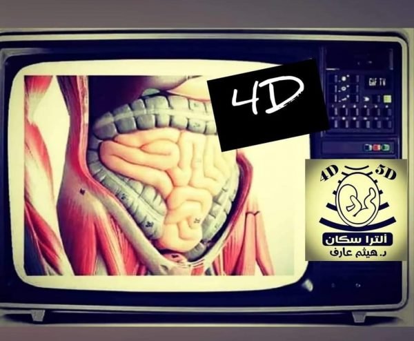 سونار رباعي الابعاد عالبطن و الحوض
