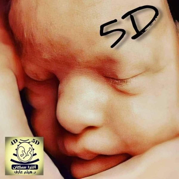 كارت الوش للبيبي بالسونار ال5D