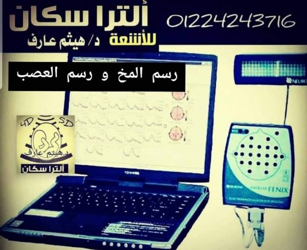 رسم المخ و رسم العصب و العضلات